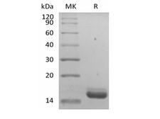 IL36RN / IL1F5 Protein - Recombinant Human IL-36 Receptor Antagonist Protein/IL-36RN/IL-1F5