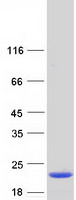 IL36RN / IL1F5 Protein - Purified recombinant protein IL36RN was analyzed by SDS-PAGE gel and Coomassie Blue Staining