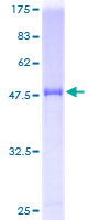 IL37 Protein - 12.5% SDS-PAGE of human IL1F7 stained with Coomassie Blue