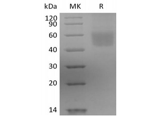 IL3RA / CD123 Protein - Recombinant Human IL-3 Receptor Subunit Alpha/IL-3RA/CD123 (C-6His)