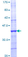 IL3RA / CD123 Protein - 12.5% SDS-PAGE Stained with Coomassie Blue.