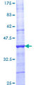 IL3RA / CD123 Protein - 12.5% SDS-PAGE Stained with Coomassie Blue.