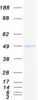 IL3RA / CD123 Protein - Purified recombinant protein IL3RA was analyzed by SDS-PAGE gel and Coomassie Blue Staining