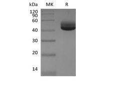 IL4 Protein - Recombinant Human IL-4 (C-Fc)