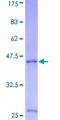 IL4 Protein - 12.5% SDS-PAGE of human IL4 stained with Coomassie Blue