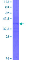 IL4 Protein - 12.5% SDS-PAGE Stained with Coomassie Blue.