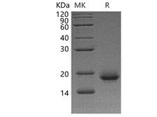 IL4 Protein - Recombinant Human Interleukin-4/IL-4 Protein-Elabscience