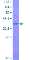IL4R / CD124 Protein - 12.5% SDS-PAGE Stained with Coomassie Blue.