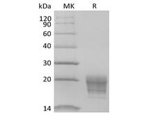 IL5 Protein - Recombinant Human IL-5 (C-6His-Avi) Biotinylated