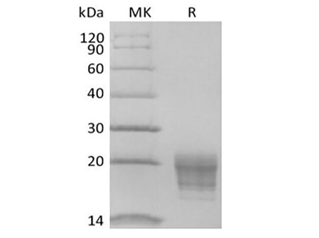 IL5 Protein - Recombinant Human IL-5 (C-6His-Avi) Biotinylated