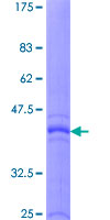 IL5 Protein - 12.5% SDS-PAGE of human IL5 stained with Coomassie Blue