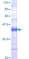IL5 Protein - 12.5% SDS-PAGE Stained with Coomassie Blue