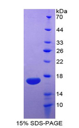 IL5 Protein - Recombinant Interleukin 5 By SDS-PAGE
