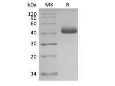 IL5 Protein - Recombinant Human Interleukin-5/IL-5 (C-mFc)