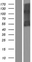 IL5RA / CD125 Protein - Western validation with an anti-DDK antibody * L: Control HEK293 lysate R: Over-expression lysate