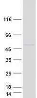 IL5RA / CD125 Protein - Purified recombinant protein IL5RA was analyzed by SDS-PAGE gel and Coomassie Blue Staining