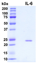 IL6 / Interleukin 6 Protein
