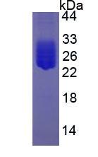 IL6 / Interleukin 6 Protein - Eukaryotic Interleukin 6 By SDS-PAGE