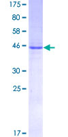 IL6 / Interleukin 6 Protein - 12.5% SDS-PAGE of human IL6 stained with Coomassie Blue