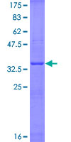 IL6 / Interleukin 6 Protein - 12.5% SDS-PAGE Stained with Coomassie Blue