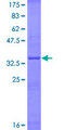 IL6 / Interleukin 6 Protein - 12.5% SDS-PAGE Stained with Coomassie Blue