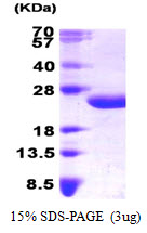IL6 / Interleukin 6 Protein