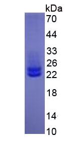 IL6 / Interleukin 6 Protein - Eukaryotic Interleukin 6 (IL6) by SDS-PAGE