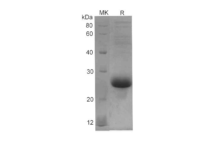 IL6 / Interleukin 6 Protein - Recombinant Human IL-6 Protein (His Tag)