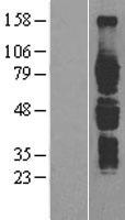 IL6R / IL6 Receptor Protein - Western validation with an anti-DDK antibody * L: Control HEK293 lysate R: Over-expression lysate