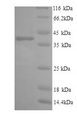 IL6R / IL6 Receptor Protein - (Tris-Glycine gel) Discontinuous SDS-PAGE (reduced) with 5% enrichment gel and 15% separation gel.