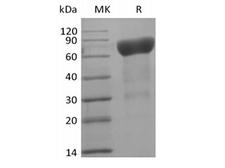 IL6R / IL6 Receptor Protein - Recombinant Human IL-6 Receptor Subunit alpha/IL-6RA/CD126 (C-Avi-6His) Biotinylated