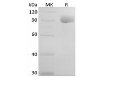 IL6R / IL6 Receptor Protein - Recombinant Human IL-6RA (C-Fc)