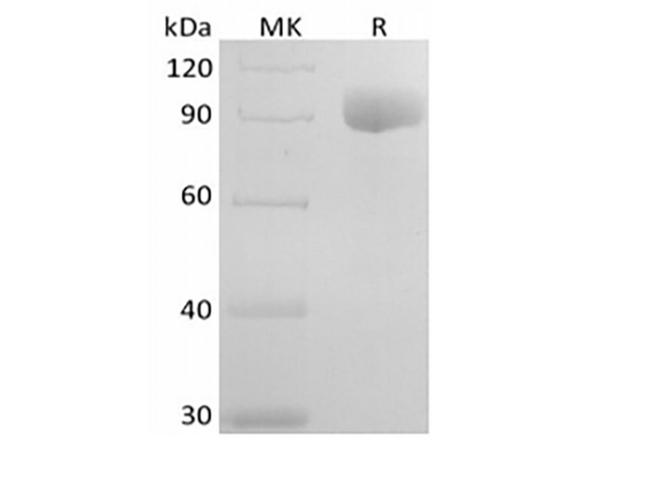 IL6R / IL6 Receptor Protein - Recombinant Human IL-6RA (C-Fc)
