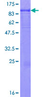 IL6R / IL6 Receptor Protein - 12.5% SDS-PAGE of human IL6R stained with Coomassie Blue