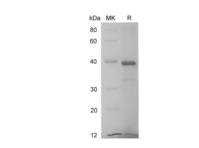 IL6R / IL6 Receptor Protein - Recombinant Human IL6R protein (His Tag)