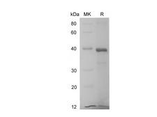 IL6R / IL6 Receptor Protein - Recombinant Human IL6R protein (His Tag)