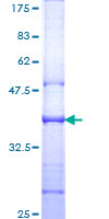 IL6ST / CD130 / gp130 Protein - 12.5% SDS-PAGE Stained with Coomassie Blue.