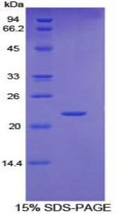 IL6ST / CD130 / gp130 Protein - Recombinant Glycoprotein 130 By SDS-PAGE