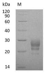 IL7 Protein - (Tris-Glycine gel) Discontinuous SDS-PAGE (reduced) with 5% enrichment gel and 15% separation gel.