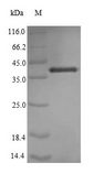 IL7 Protein - (Tris-Glycine gel) Discontinuous SDS-PAGE (reduced) with 5% enrichment gel and 15% separation gel.
