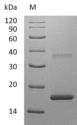 IL7 Protein - (Tris-Glycine gel) Discontinuous SDS-PAGE (reduced) with 5% enrichment gel and 15% separation gel.