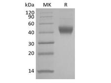 IL7R / CD127 Protein - Recombinant Human IL-7 Receptor Subunit alpha/IL-7RA/CD127 (C-6His)