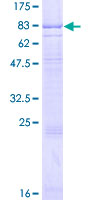 IL7R / CD127 Protein - 12.5% SDS-PAGE of human IL7R stained with Coomassie Blue