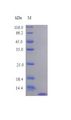 IL8 / Interleukin 8 Protein