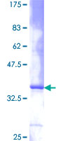 IL8 / Interleukin 8 Protein - 12.5% SDS-PAGE of human IL8 stained with Coomassie Blue