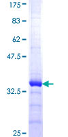 IL8 / Interleukin 8 Protein - 12.5% SDS-PAGE Stained with Coomassie Blue.