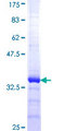 IL8 / Interleukin 8 Protein - 12.5% SDS-PAGE Stained with Coomassie Blue.
