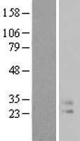 IL9 Protein - Western validation with an anti-DDK antibody * L: Control HEK293 lysate R: Over-expression lysate