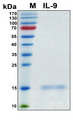 IL9 Protein - SDS-PAGE under reducing conditions and visualized by Coomassie blue staining
