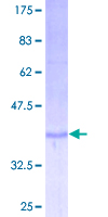 IL9 Protein - 12.5% SDS-PAGE of human IL9 stained with Coomassie Blue